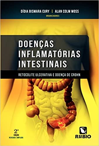 Doenças Inflamatórias Intestinais- Retocolite Ulcerativa e Doenças de Crohn